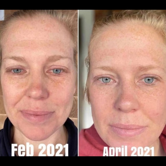 Multi-patented Liquid BioCell - Liquid Collagen https://modere.co/3CKXFAh - Picture 7 of 16